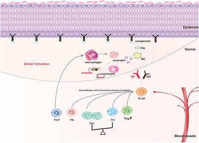 Emerging Biomarkers and Therapeutic Strategies for Refractory <mark class="highlighted">Bullous Pemphigoid</mark>